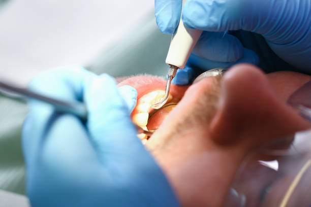 Best Dentist for Tooth Abscess  in Winooski, VT